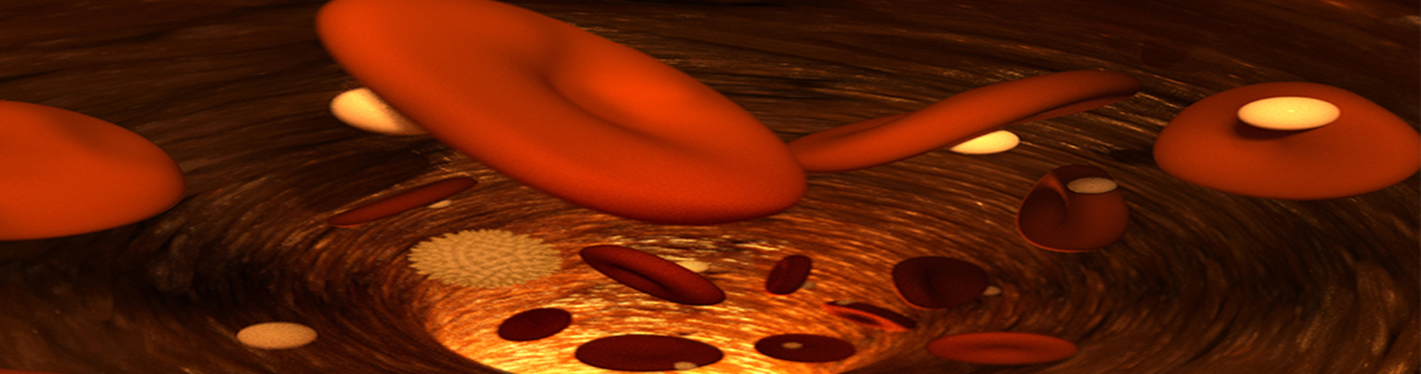 blood_slider